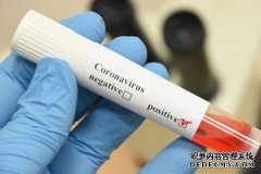 机器人、沐鸣测速激光和唾液:研究人员开发出创新的方法来测试Covid-19