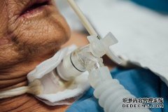 计划为较贫穷国家提供低成本的新冠肺炎呼吸机